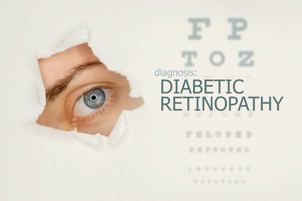 Woman's eye accompanied by text that reads Diagnosis: Diabetic Retinopathy