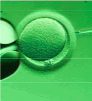 Intracytoplasmic Sperm Injection (ICSI) Process