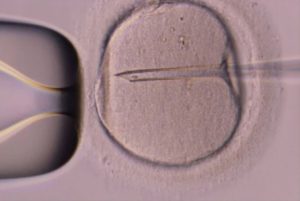 In vitro fertilization vs. intracytoplasmic sperm injection