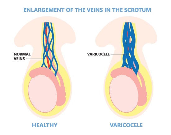 Male Fertility Doctor in Los Angeles and San Francisco