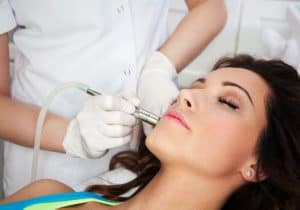 microdermabrasion san diego