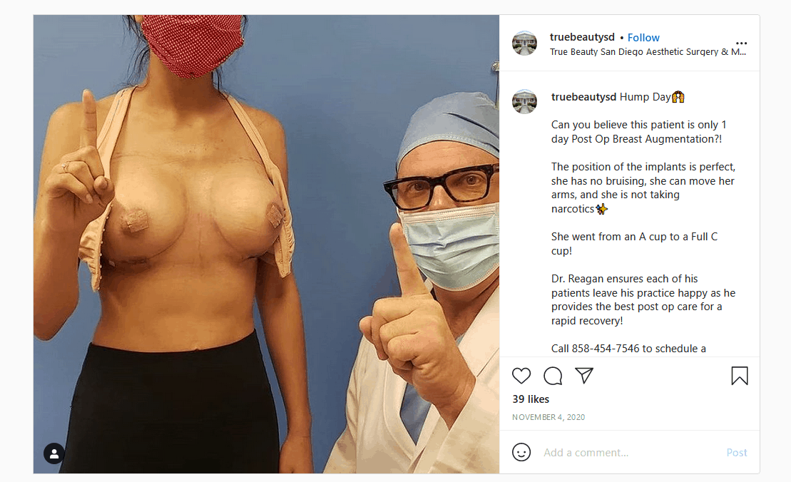 Breast Augmentation in La Jolla & San Diego