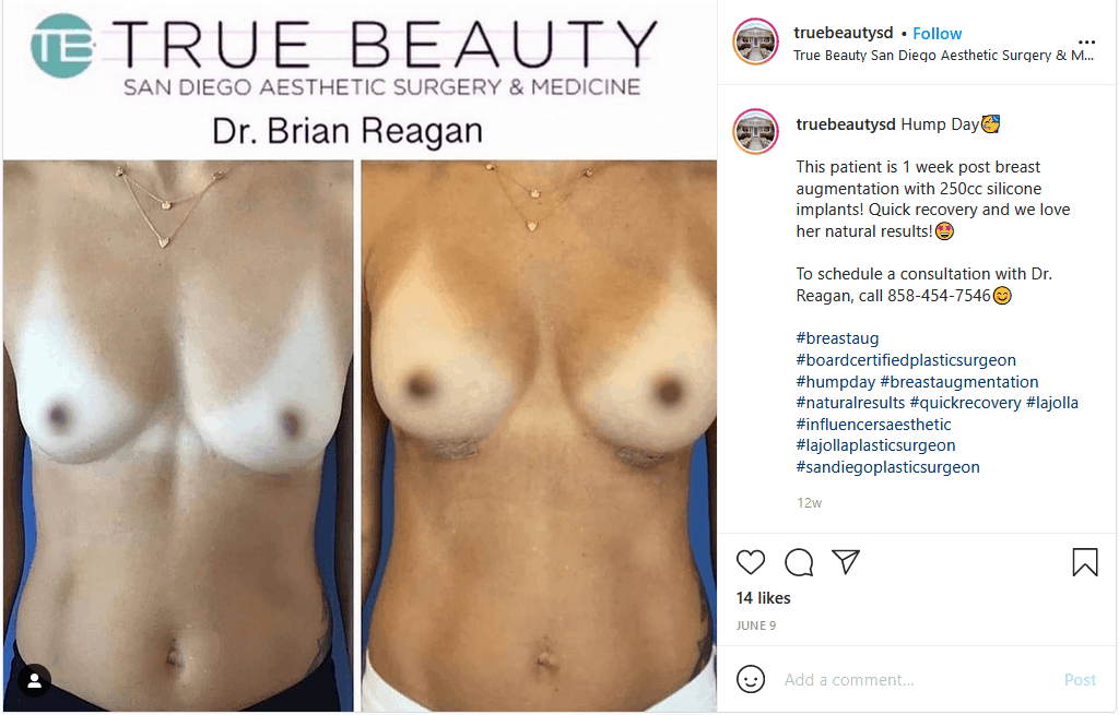 Tiny Breast Pictures 