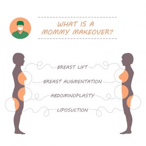Mommy Makeover Areas of focus Infographic