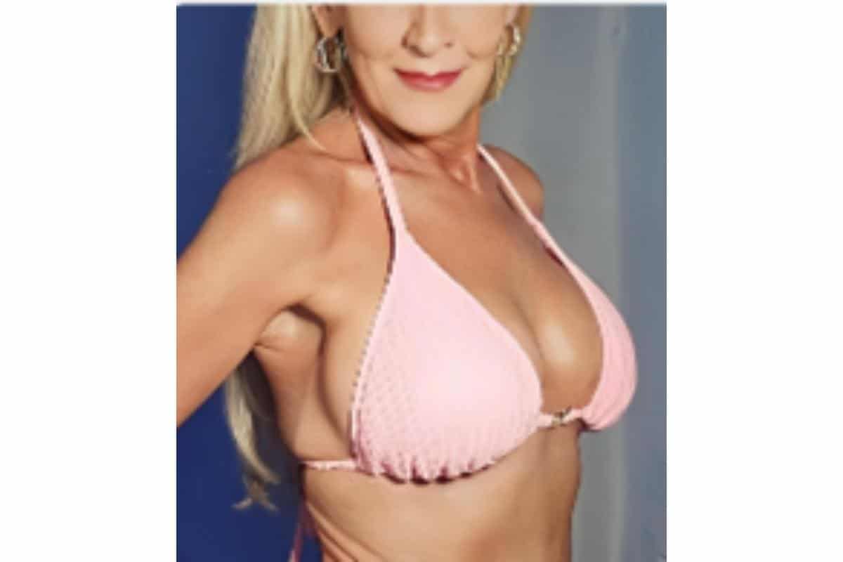 Breast Augmentation San Diego