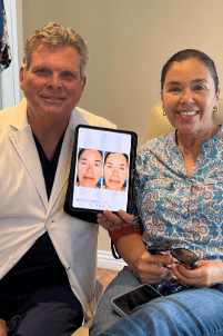 Woman with dermal filler and refined features in San Diego, CA