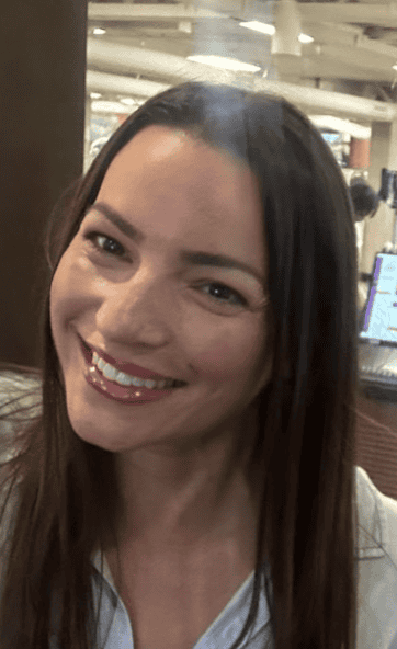 Woman with refined results after Morpheus8 treatment in San Diego, CA